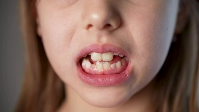 Little girl shaking tongue milk tooth in mouth, close-up