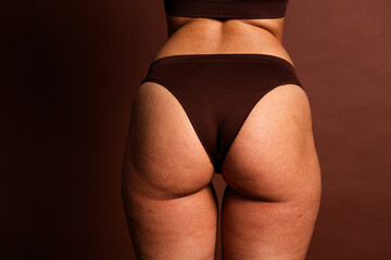 Cropped photo of pretty plus size lady underwear standing back accepting imperfect skin isolated...