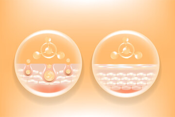 Fototapeta premium Hyaluronic acid and Niacinamide before and after hair and skin solutions ad, gold collagen serum drops into skin cell with cosmetic advertising background ready to use, illustration vector.