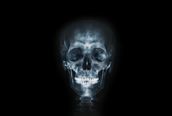 Fototapeta premium X-ray film human's skull and cervical spine lateral view, close up