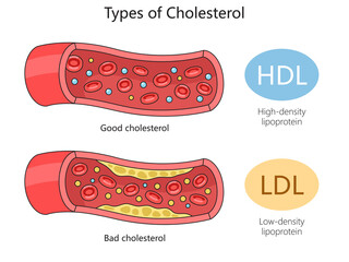 HDL (good) cholesterol and LDL (bad) cholesterol in blood vessels for health education diagram hand drawn schematic raster illustration. Medical science educational illustration