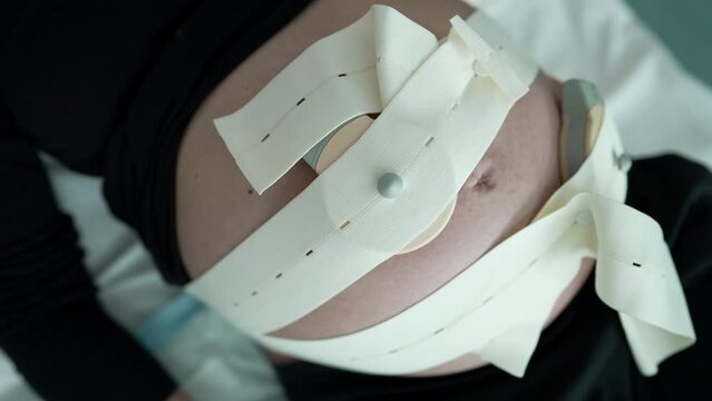 Expectant mother's 9 month belly during prelabor with straps for fetal heart rate monitoring, top view angle close-up. Pregnancy care equipment