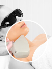Elos epilation hair removal procedure on the face of a woman. Beautician doing laser rejuvenation...