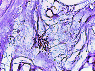 photo of cross section in small intestine jejunum as seen by the microscope