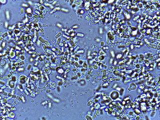 photo of fungi spores and mycelium under the microscope