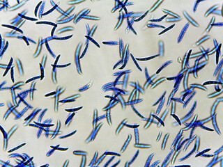 photo of fungi mold mycelium growth and spores under the microscope