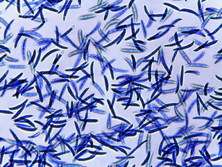 photo of fungi mold mycelium growth and spores under the microscope