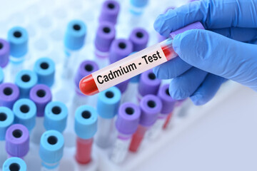 Doctor holding a test blood sample tube with Cadmium (CD test on the background of medical test...