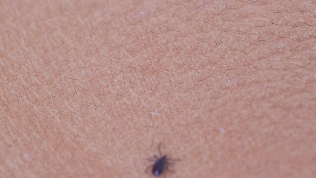 parasitiform tick Ixodidae, blood-sucking parasites crawls on skin, Acariformes, carrier of dangerous disease encephalitis, illness symptoms, tick-borne disease prevention strategies, research studies