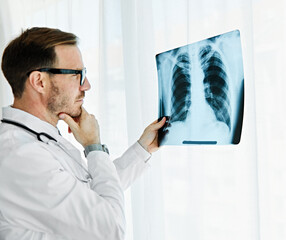 doctor hospital medical x-ray health medicine healthcare radiology man lung chest diagnosis disease...