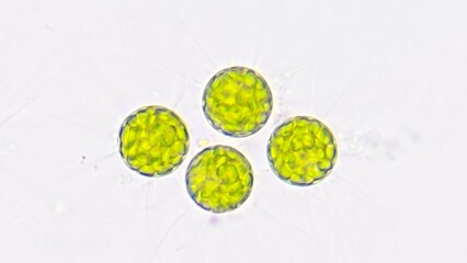Freshwater microalgae, Golenkinia sp. Live cell. Selective focus image
