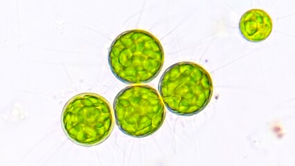 Freshwater microalgae, Golenkinia sp. Live cell. Selective focus image