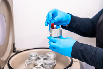 Expertise placing blood samples in vials on a centrifuge machine
