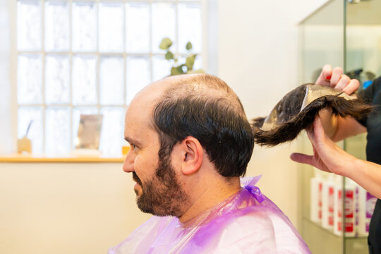 Hairstylist removing the capillary prosthesis from head of a man