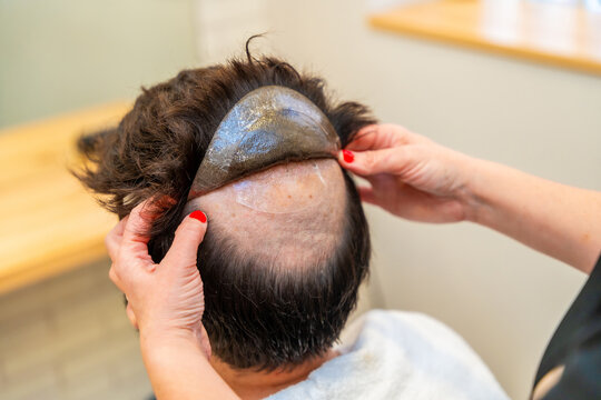 Hairdresser attaching a hairpiece using adhesive stickers