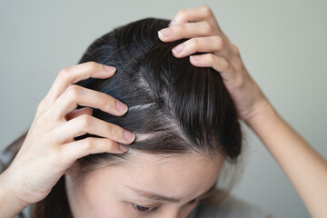 Naklejka premium Young woman worrying about her thin hair and hair fall