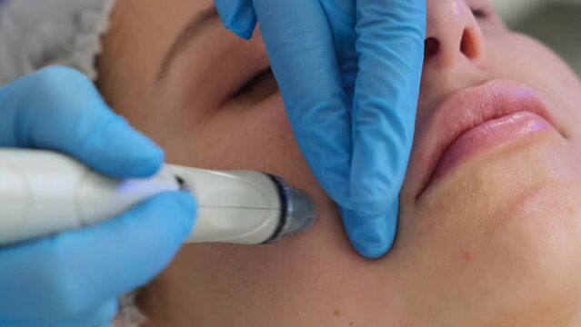 Professional moisturizing and rejuvenating hardware procedure. Hydrafacial massage process. Close-up shot of a young woman receiving microdermabrasion therapy at beauty spa.