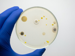 Bacteria that cause dangerous human diseases grew on test media in a petri dish.