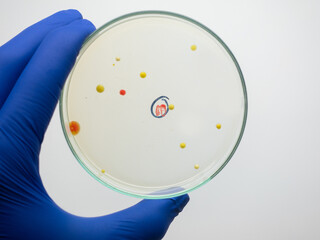An isolated colony of bacteria on a petri dish, different colonies of bacteria on a test edit.
