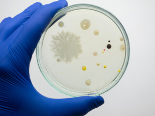 A petri dish with colonies of bacteria, in the background a working microscope magnifies bacterial cells.