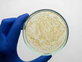 Many colonies of bacteria grew on a nutrient medium in a petri dish.