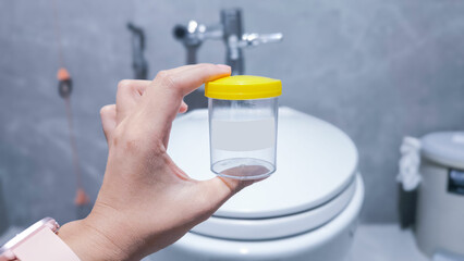 medical specimen collection bottle , urine test jar on the flush toilet
