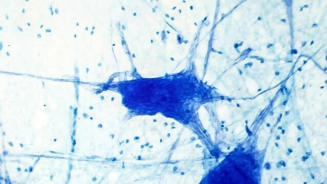 Normal brain tissue, light microscopy