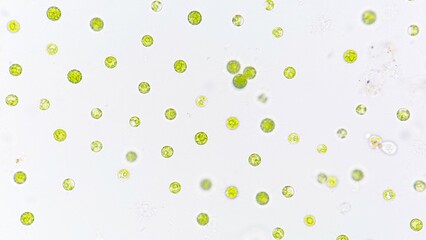Green algae (Golenkinia sp) blooming under microscope. 40x objective. Selective focus