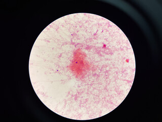 red bacteria cell branching in hemoculture.