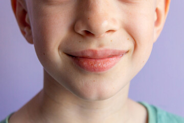 Mouth of a 9 years old boy. Close-up of a child with adorable smile. Smiling boy