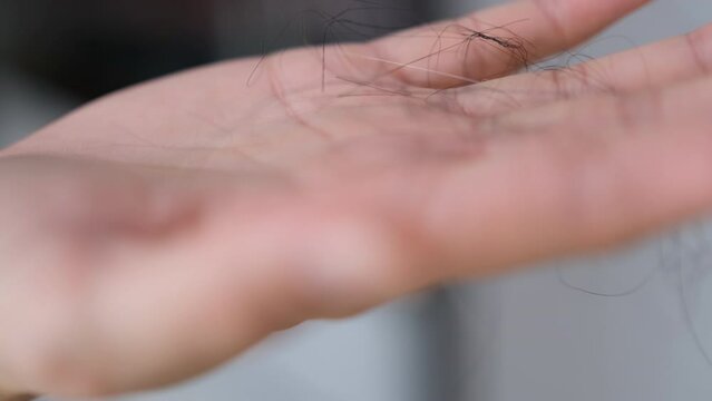 Asian woman rubs her hair and hair falls out on her hands