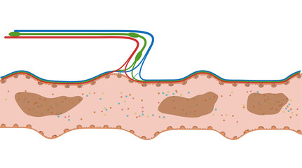 Darmzotten des Ileum oder Krummdarm  - der Dünndarm im Verdauungstrakt des Menschen - Anatomie