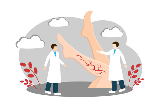 Varicose veins. Vascular Surgeon. Vector