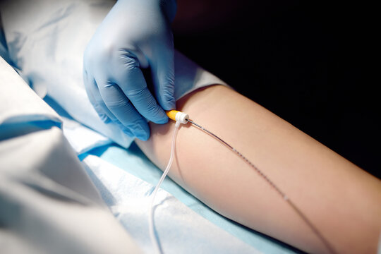 Professional vascular surgeon is in the operating room of the clinic during vein surgery. Phlebectomy. Modern technology of deep vein thrombosis treatment.