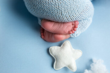 the legs of the newborn baby. the legs of the newborn flaky skin. peel off the skin. peeling skin newborn. newborn child. feet