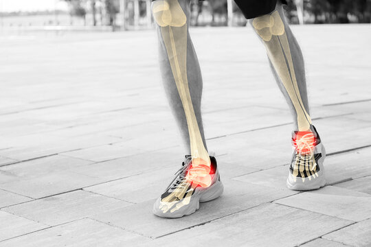 Doctor hands in medical gloves fitting orthopedic insoles to female legs on beige background, closeup
