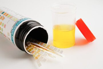 Urinalysis, urine cup for check health examination in laboratory.