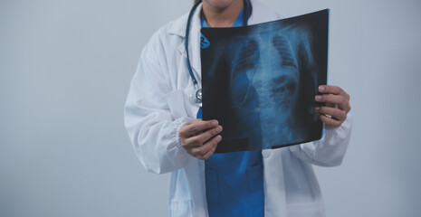 Asian Muslim doctor in hijab and scrubs headphones around her neck Stand confidently in the medical office, isolated on white background, holding x-ray film.