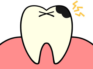 虫歯のイラスト素材