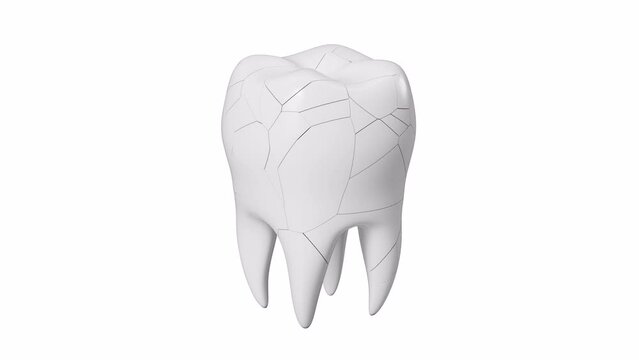 Human tooth model, tooth cracking, oral rehabilitation, alpha channel, 3d rendering.