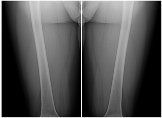 X-ray images are mirror-symmetrically arranged