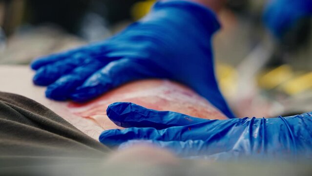 Close up a confident medic in blue rubber gloves applies a special large plaster to the wound site of a soldier to avoid blood loss in combat conditions during first aid