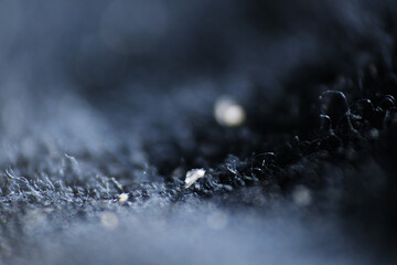 Macro of dandruff on shirt. Dandruff flakes are larger and may be yellow tinged or look oily