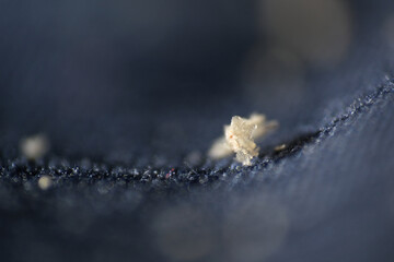 Macro of dandruff on shirt. Dandruff flakes are larger and may be yellow tinged or look oily