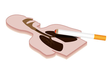Vector illustration of unhealthy lungs diagram with smoking cigarette on transparent background