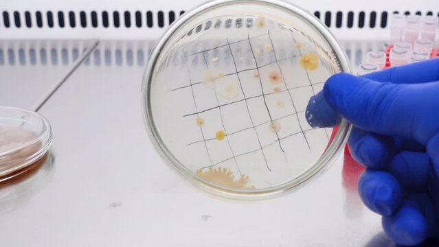 A scientist analyzes a colony of bacteria in close-up in a petri dish marked into sectors and places a test tube with a green liquid.