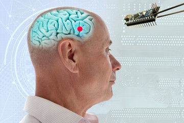 Installing electronic chip into human brain, applied in various fields neurotechnology and medical...