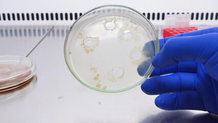 A scientist points his finger at areas of bacterial growth around the holes in a Petri dish.