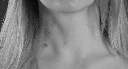 Close-Up Human Neck Skin Detail Black And White