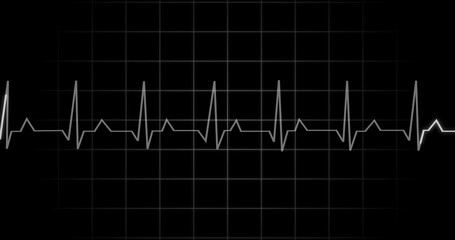 Naklejka premium EKG Heartbeat reading animation on black background. Medical monitor displaying cardiography pulse checkup diagnosis electronic screen display machine. Cardiogram nubes rate ecg waveform surgery.